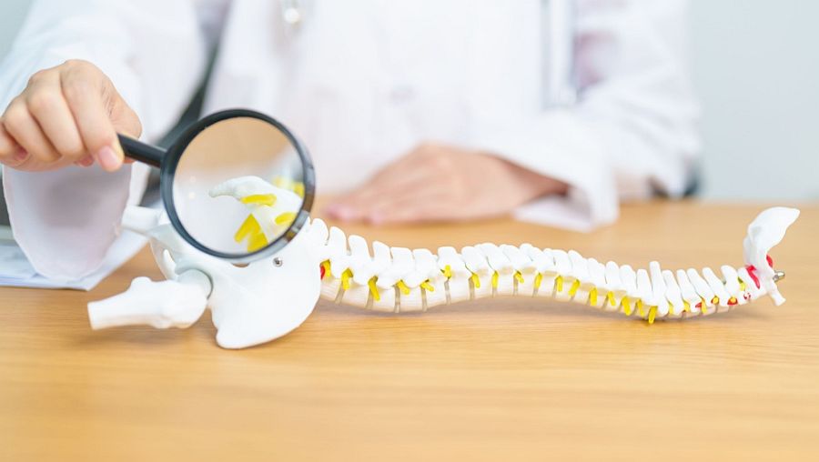 Κύστη Κόκκυγος – Σύγχρονη Αντιμετώπιση με Laser (μέθοδος SiLaC) 