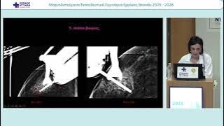 ΓΚΑΛΙ-20260402